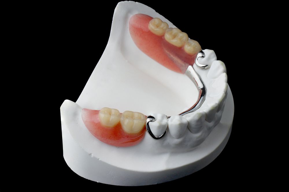 DENTURES Partial Dentures v dental gajuwaka