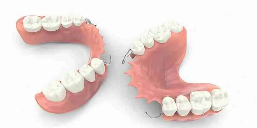 Removable Partial Dentures 5
