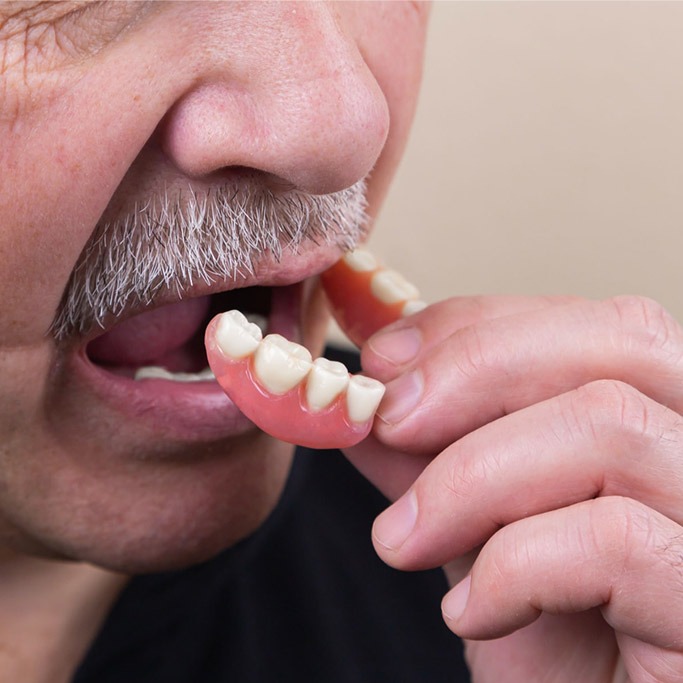 partial denture gajuwaka