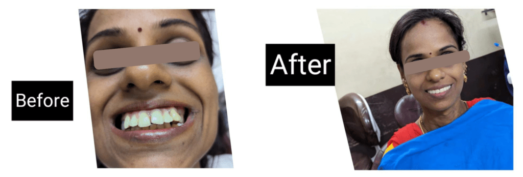 Ortho Treatment