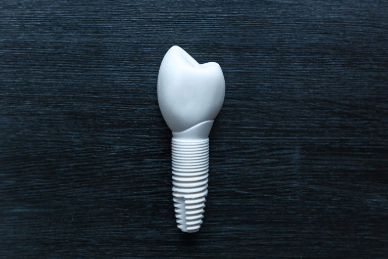 Zirconia Implants: The Metal-Free Alternative