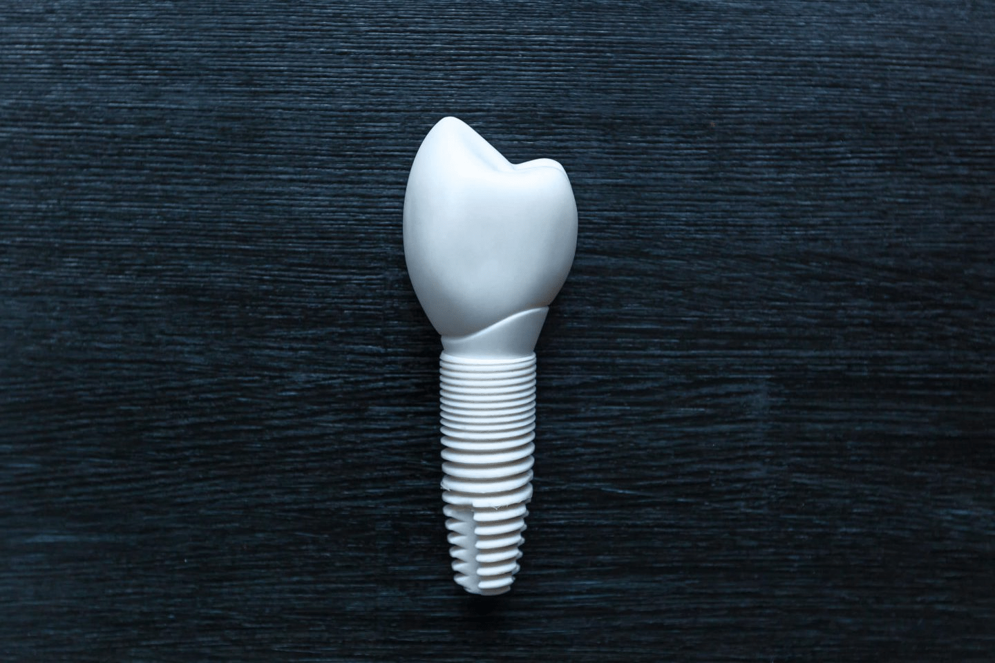 Non Metallic implants v dental gajuwaka