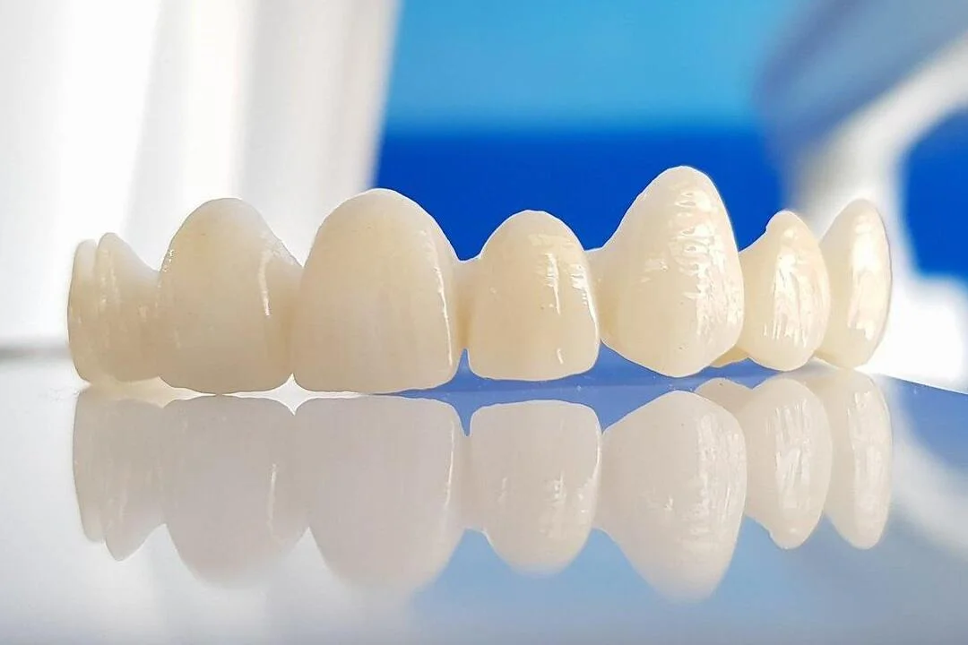 Zirconia Crowns v dental gajuwaka