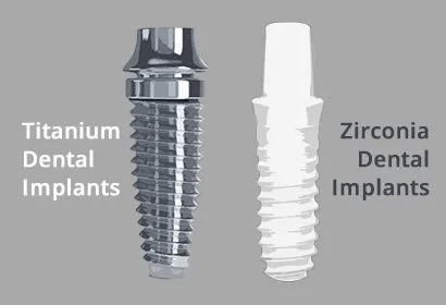 Zirconia Implants v dental gajuwaka